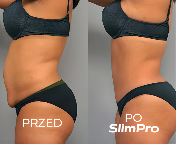 SlimPro Kompletny Zestaw